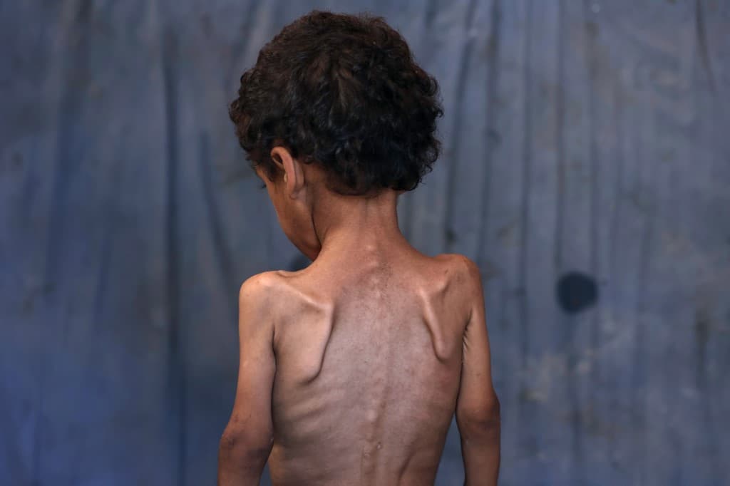 Gaza death toll rises | Middle East Eye