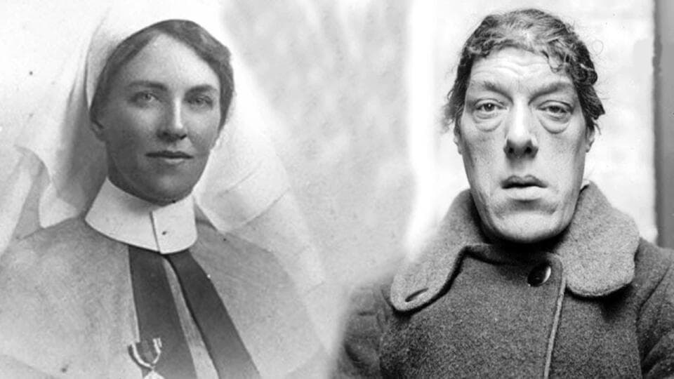 Mary Ann Webster | Dünyanın En Çirkin Kadını